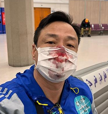 王喜PCR溅血发文“追凶” 护理师好友还原现场狠打脸