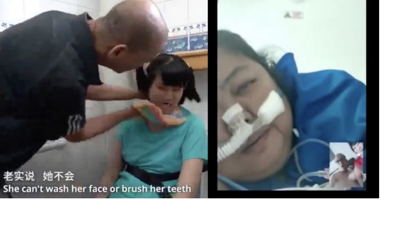 男子一边工作一边照顾智障女 还担心失去患多重病症确诊妻