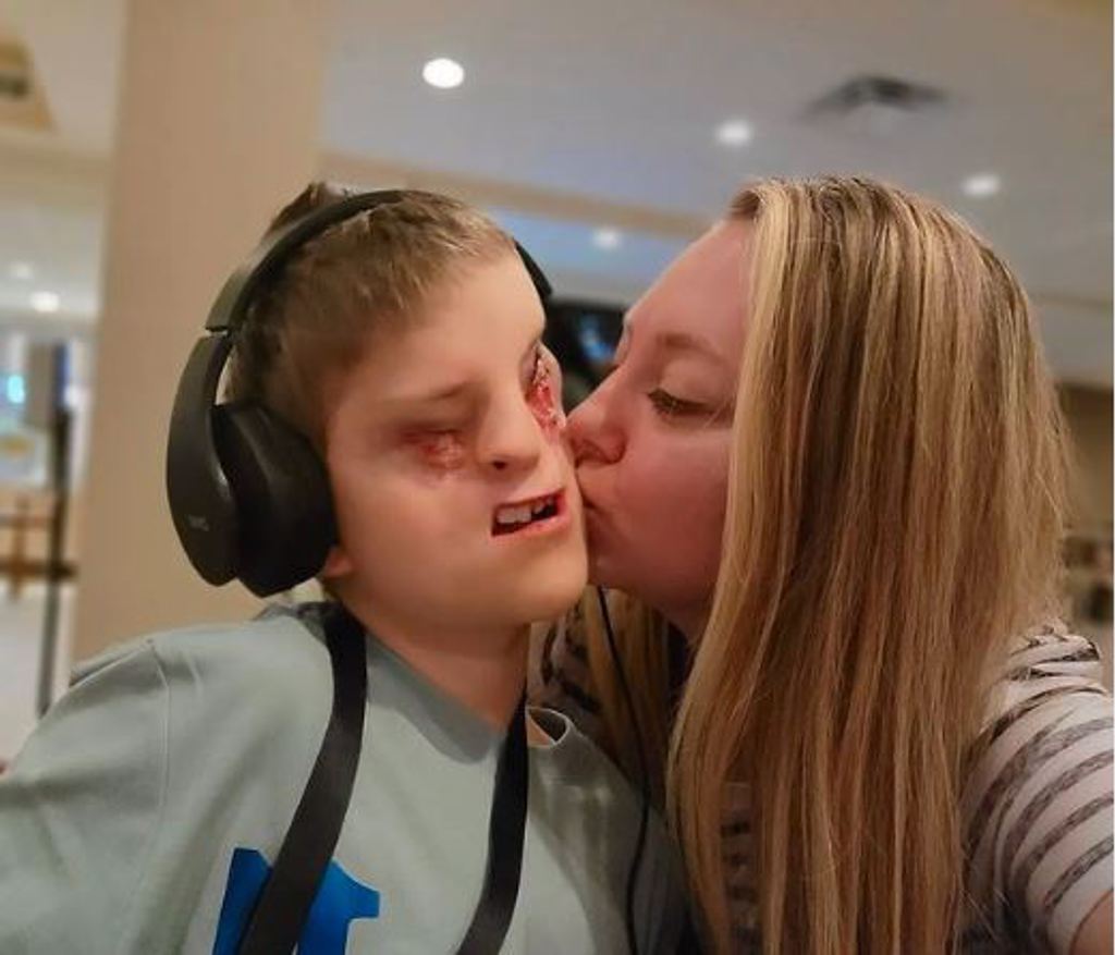 视频|11岁童天生颜面畸形 满意自己的样子不再整容