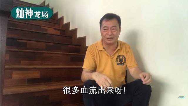 阿灿廖伟雄自封肾结石专业户 曾遭误诊割错盲肠