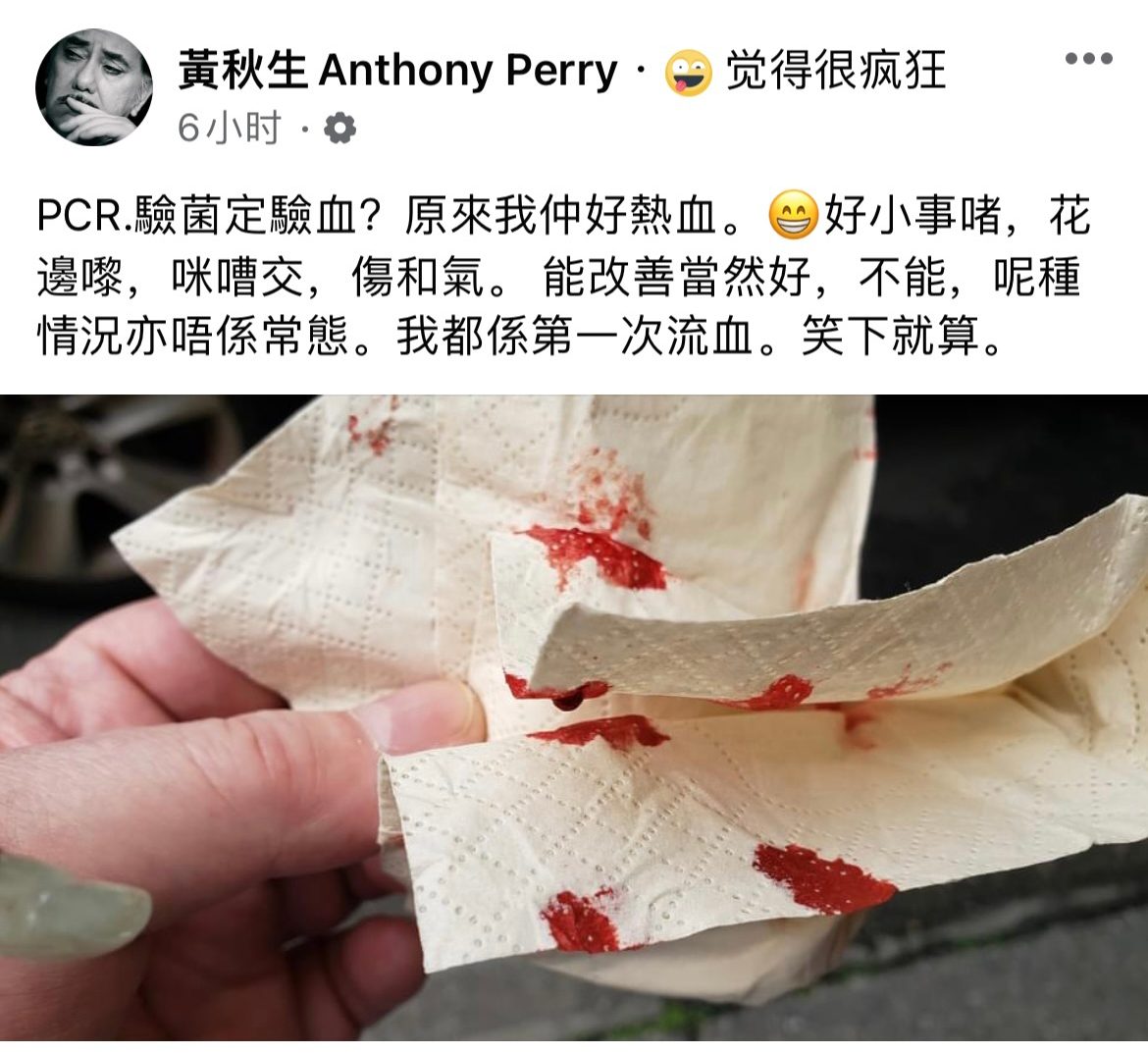 台做检测捅伤流鼻血引骂战 黄秋生:小事别吵架