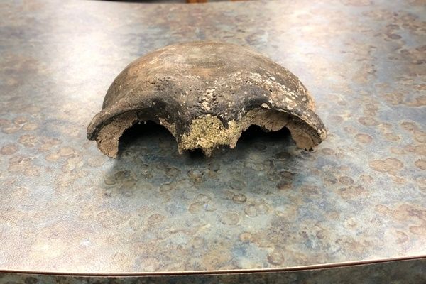 拼盘/河边捡到凹陷头骨 竟是“8000年前的他”