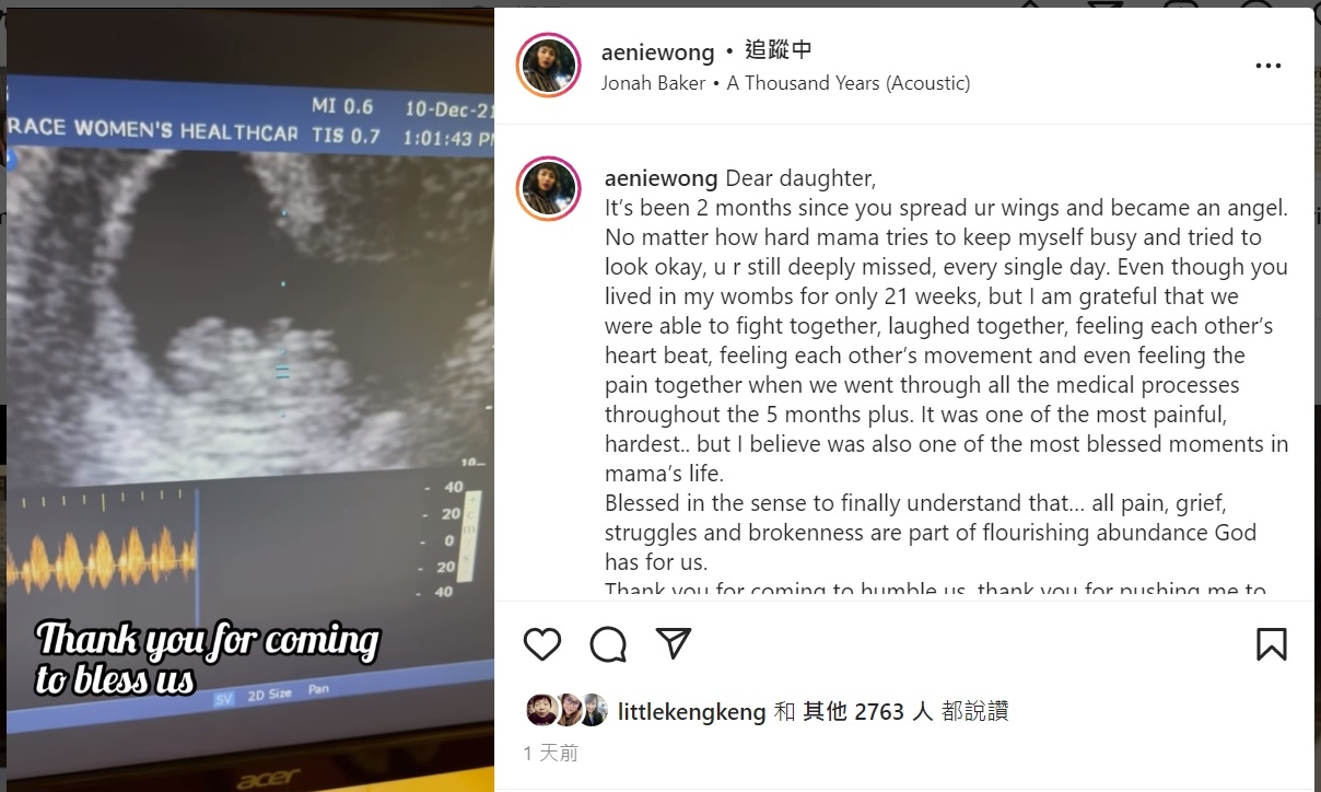 王淑君怀胎5个月流产  喊话无缘女儿：很想你