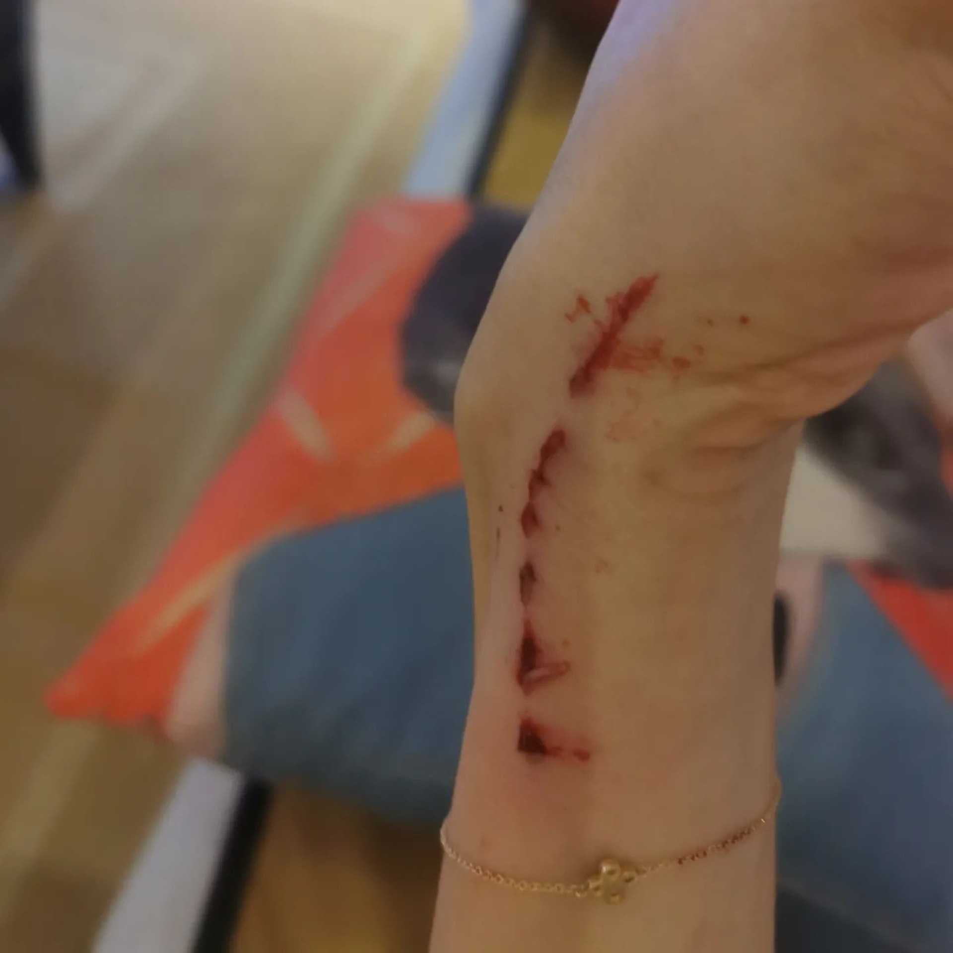 黎淑贤遭豹猫袭击 全身血迹斑斑紧急入院