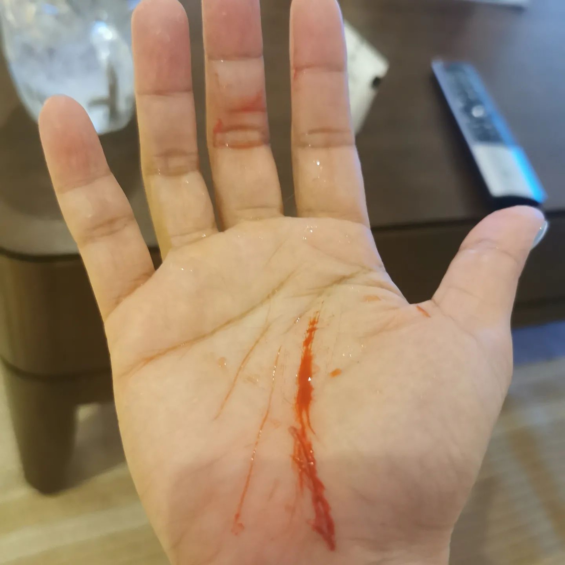 黎淑贤遭豹猫袭击 全身血迹斑斑紧急入院