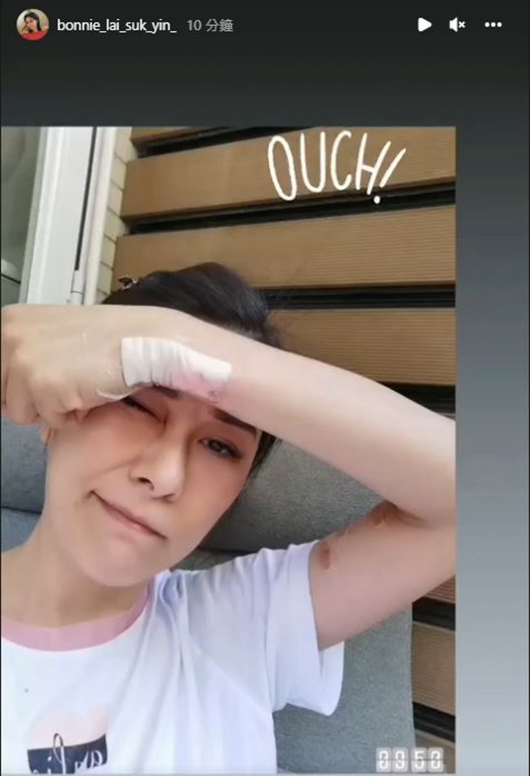 黎淑贤遭豹猫袭击 全身血迹斑斑紧急入院