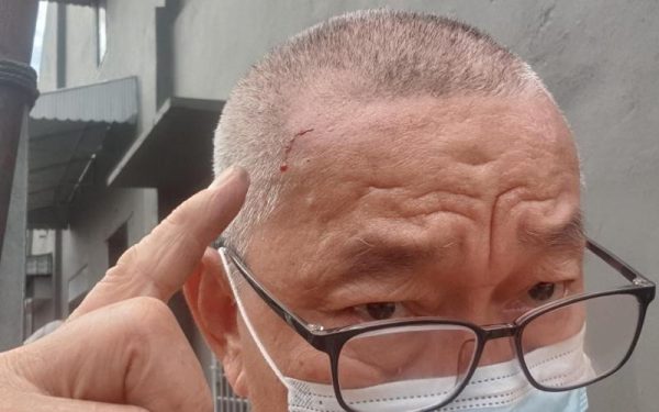 告示牌过低 公众不察遭弄伤