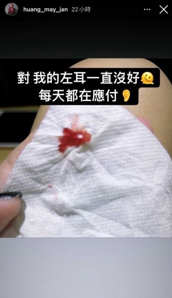 左耳流血流脓好不了  黄美珍放宽心共存 