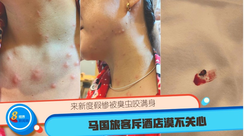 *已签发*柔：狮城二三事：来新度假惨被臭虫咬满身 大马旅客斥酒店漠不关心