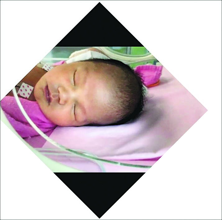 张致恒3度当爸 宝宝早产一出世送ICU插管