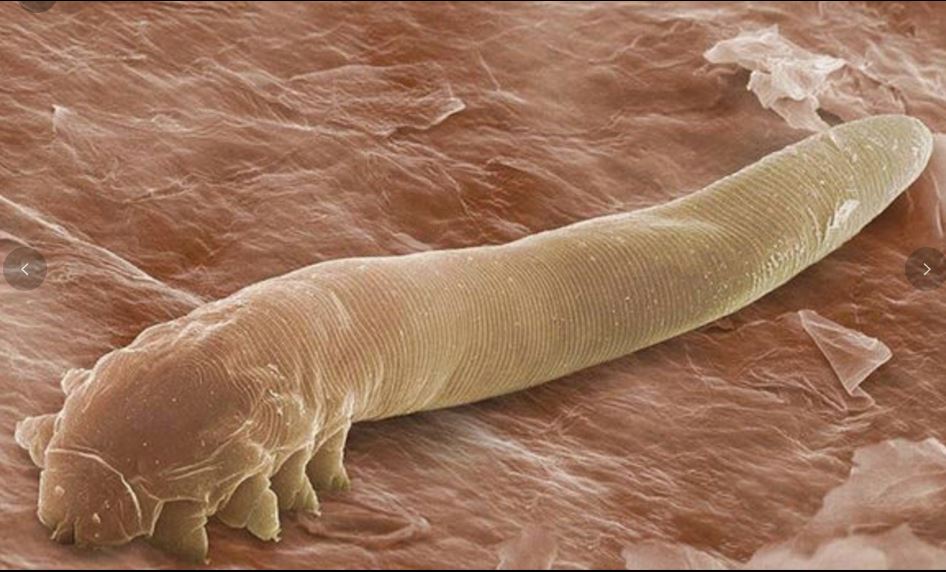 拼盘 研究:人类毛孔住满八脚螨虫 近亲繁衍基因改变