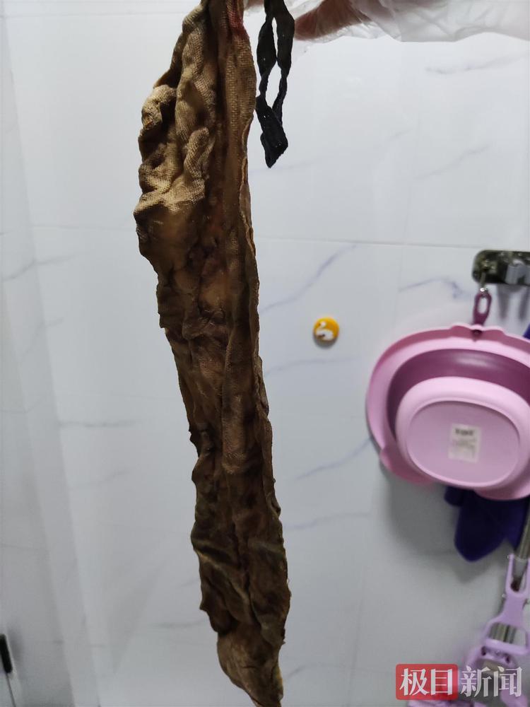 视频|女产后纱布藏下体2个月 医院:助产士失误愿赔偿