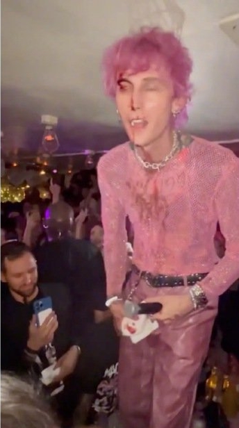 MGK酒杯自砸脑门 头破流血继续表演吓坏人 