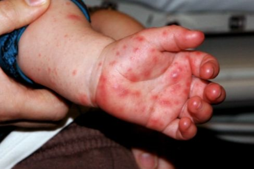 东:劳勿卫生局长:18岁以上的市民在咨询医生后,可以接种第4针疫苗