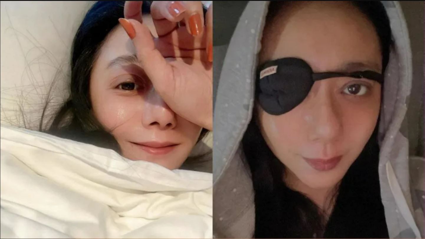 双眼一高一低无法对焦 高慧君爆隐疾1年惨零收入