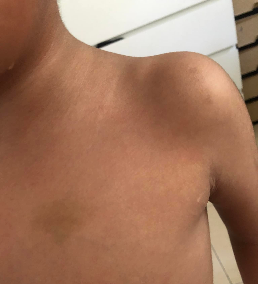 **已签发**柔：第二版头条（最新）：自闭儿证实遭虐却不见警采取行动，母愤而公开详情得警方回应在调查中