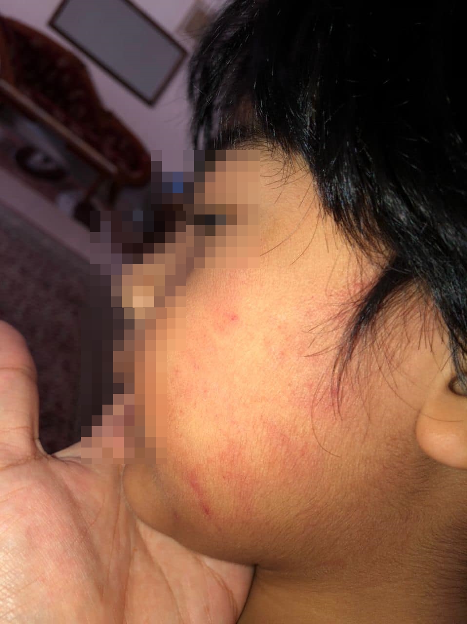 **已签发**柔：第二版头条（最新）：自闭儿证实遭虐却不见警采取行动，母愤而公开详情得警方回应在调查中