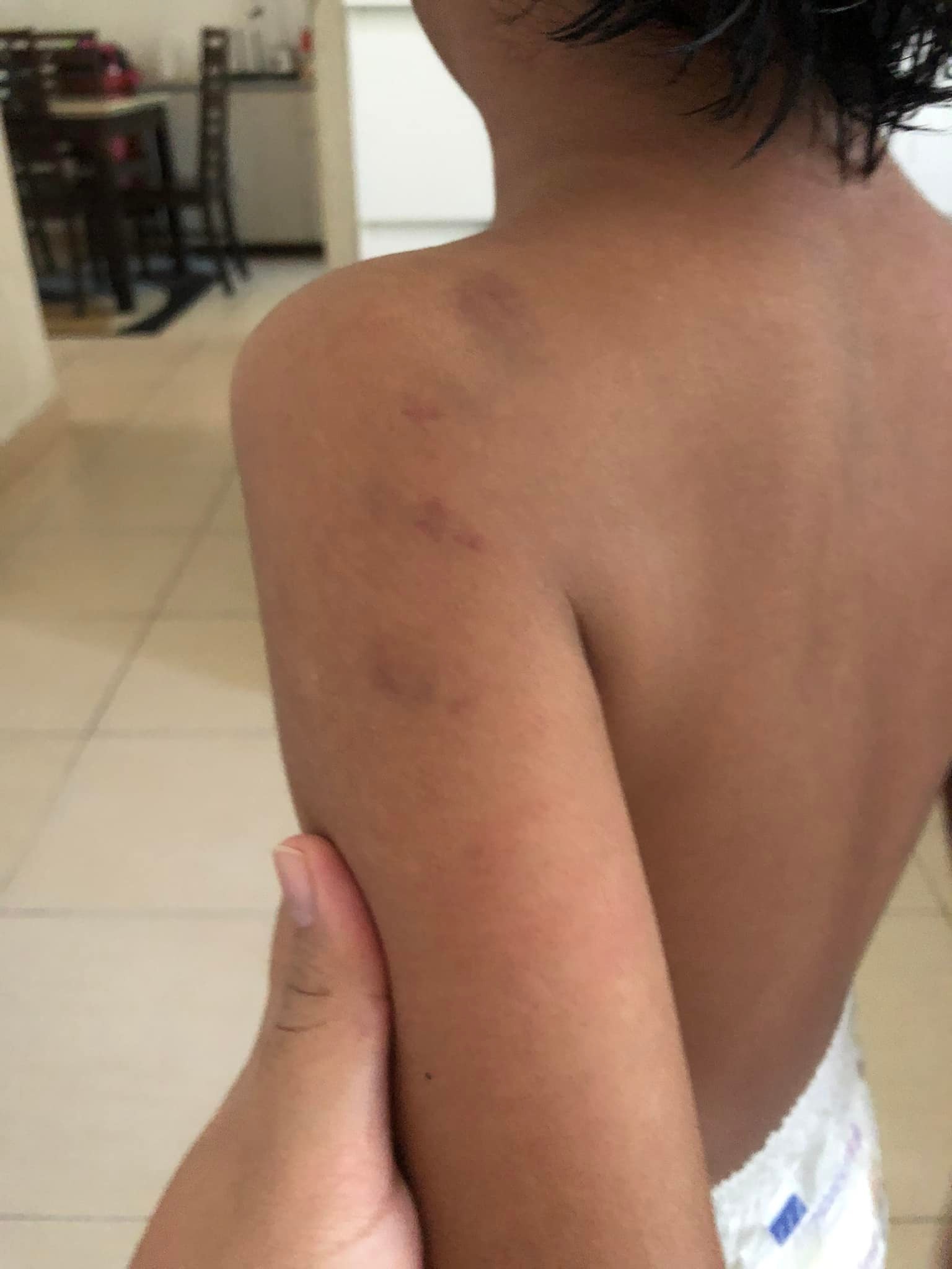 **已签发**柔：第二版头条（最新）：自闭儿证实遭虐却不见警采取行动，母愤而公开详情得警方回应在调查中