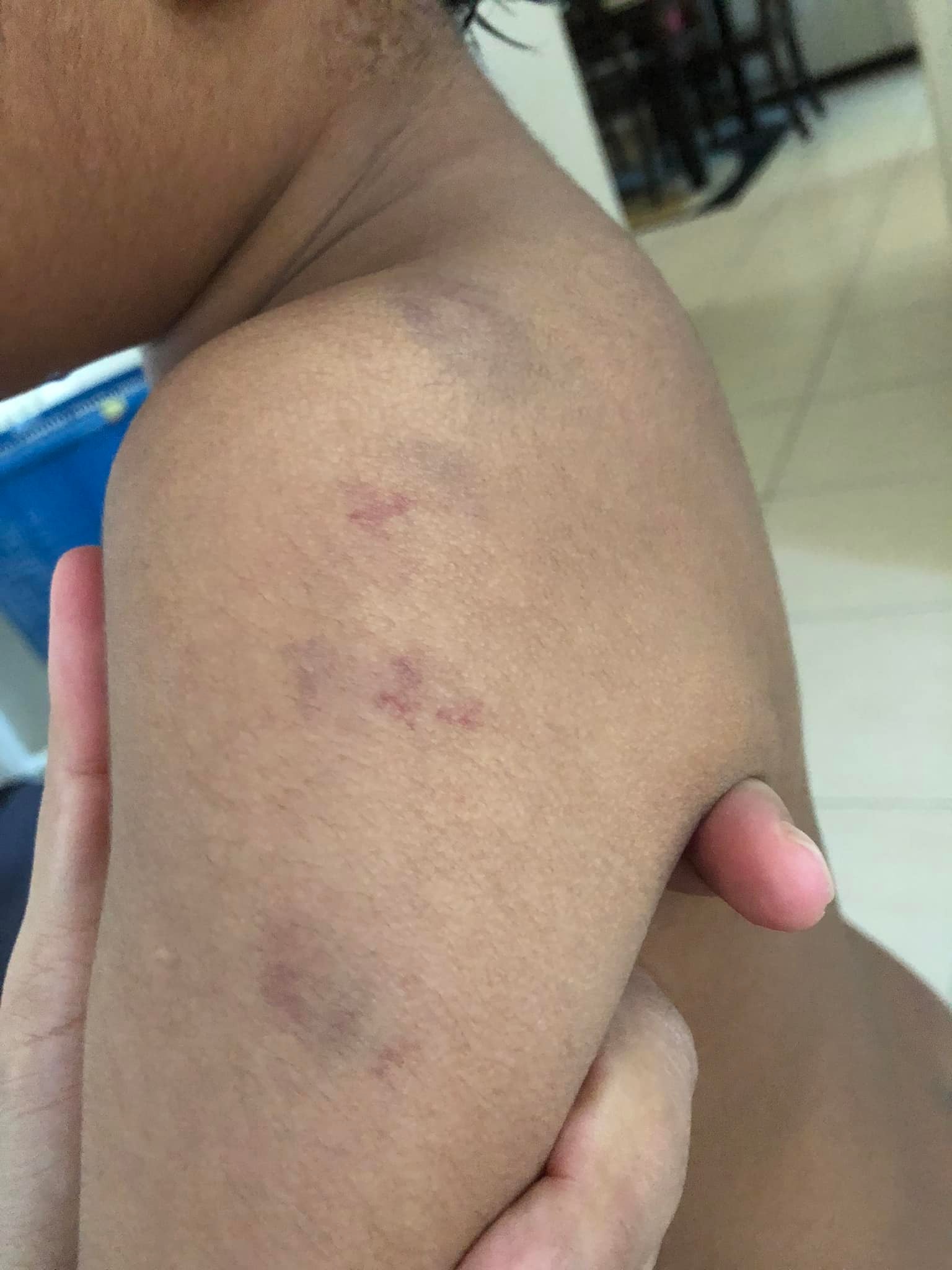 **已签发**柔：第二版头条（最新）：自闭儿证实遭虐却不见警采取行动，母愤而公开详情得警方回应在调查中