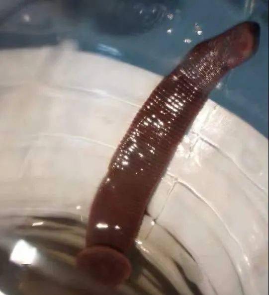 拼盘/男子频频流鼻血 求医始知鼻腔藏蚂蟥