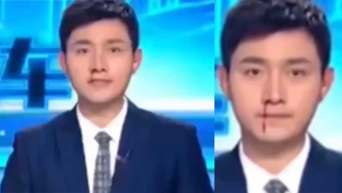 拼盘／苏州主播流鼻血仍淡定报新闻 网民狂赞够专业