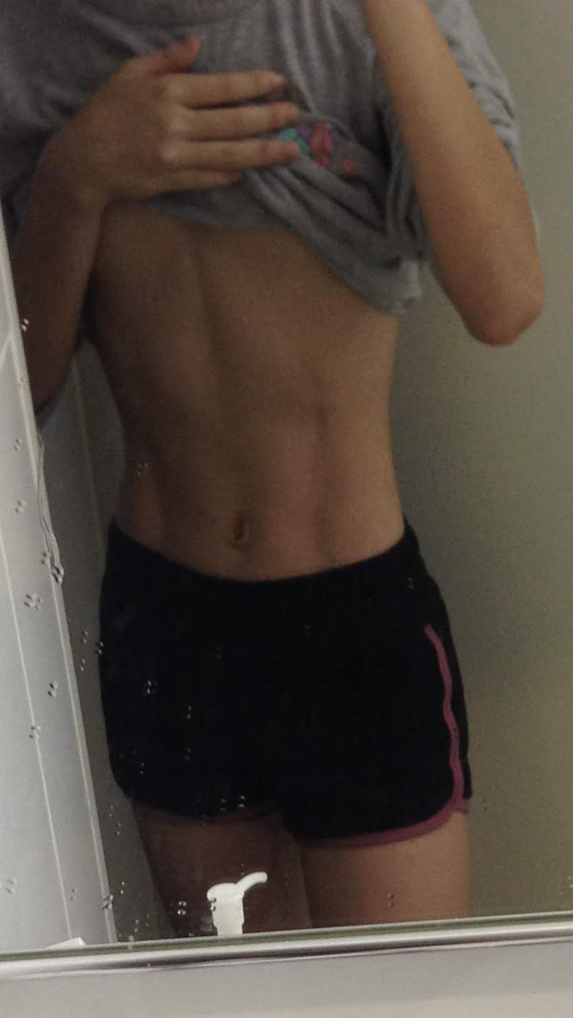 曾节食过度罹厌食症 刘思玮被父母下禁爱令