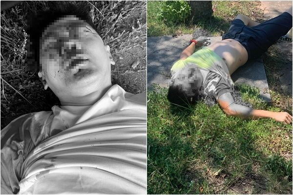 林志颖载儿自撞起火 疑满头血倒地照外流