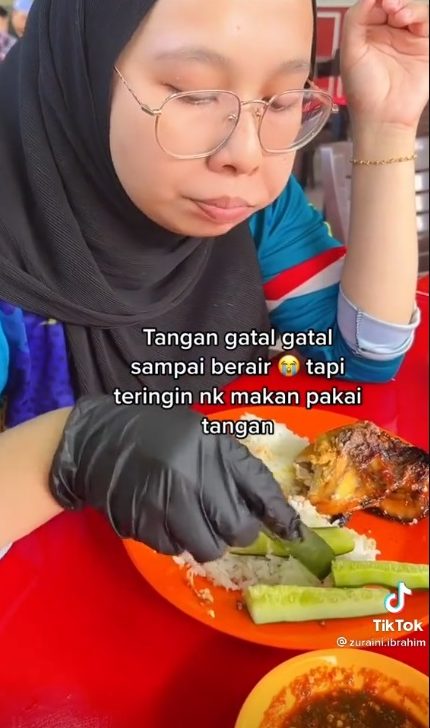 视频|患湿疹不能做家务煮三餐 女子:抓饭吃也要戴手套!