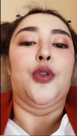 J女郎李心艾昔暴肥 2年减20公斤瘦成皮包骨惊呆网