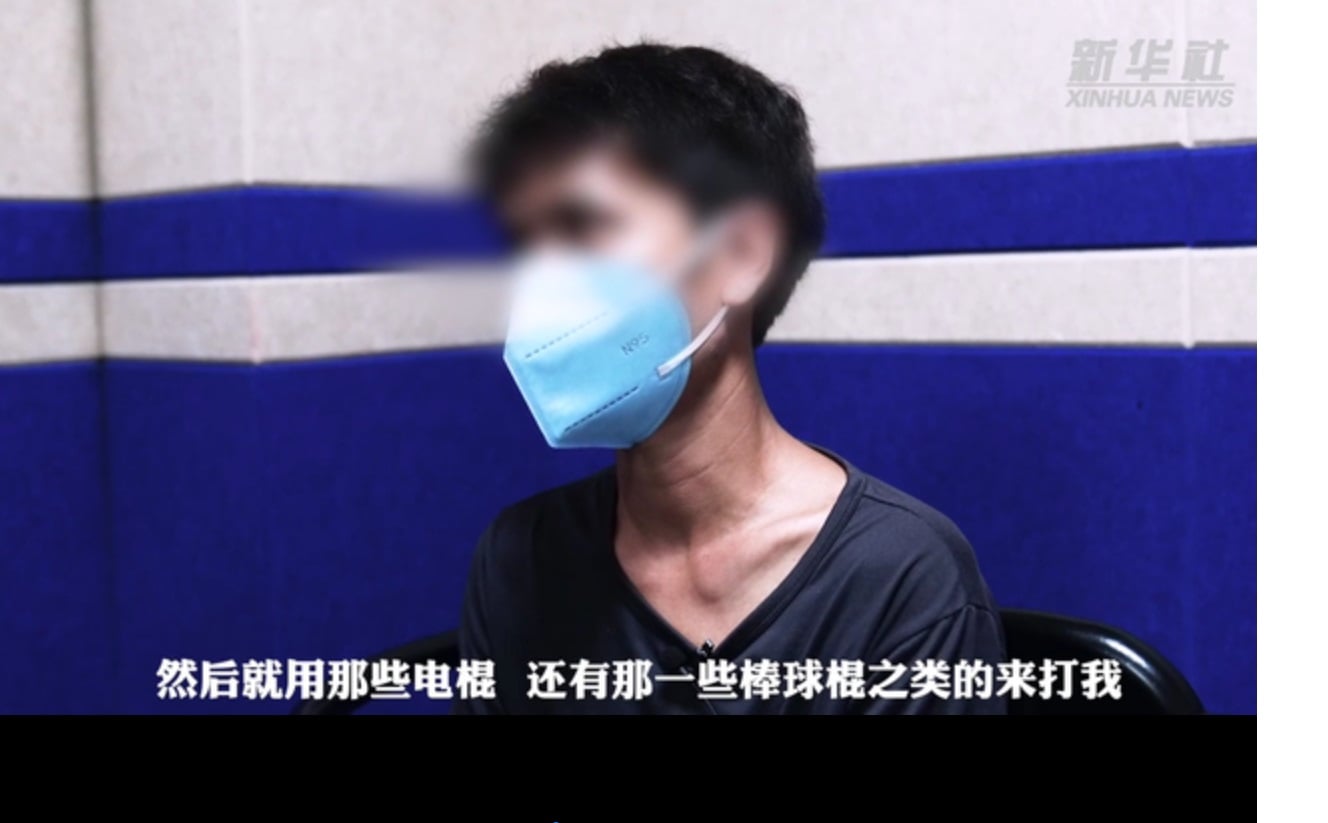 中国男子冒死逃回云南亲述惨况 关黑房遭电棍殴打迫食狗粮