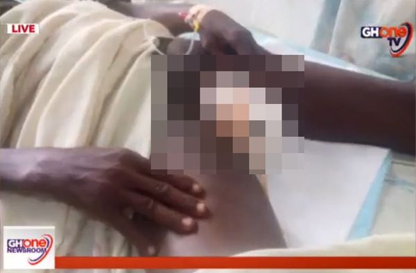 他睡觉梦见切肉情景　醒来惊觉“割破自己睾丸”握着流血下体求医