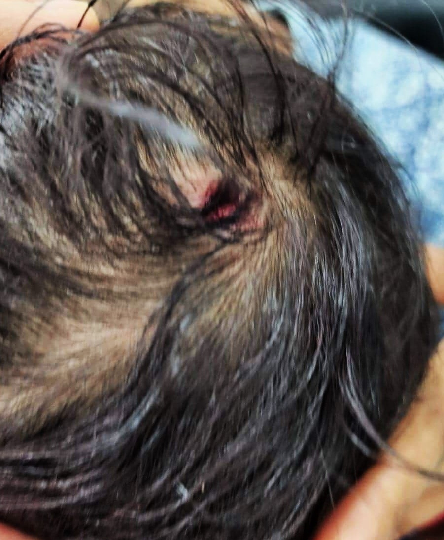 儿子摔破头仍坚守岗位 医生抱伤儿看诊获赞