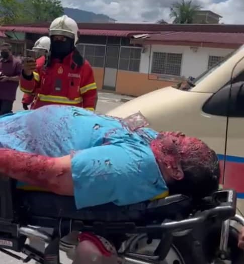 全国版/已签/求真︱太平医院厨师发生殴斗受伤?