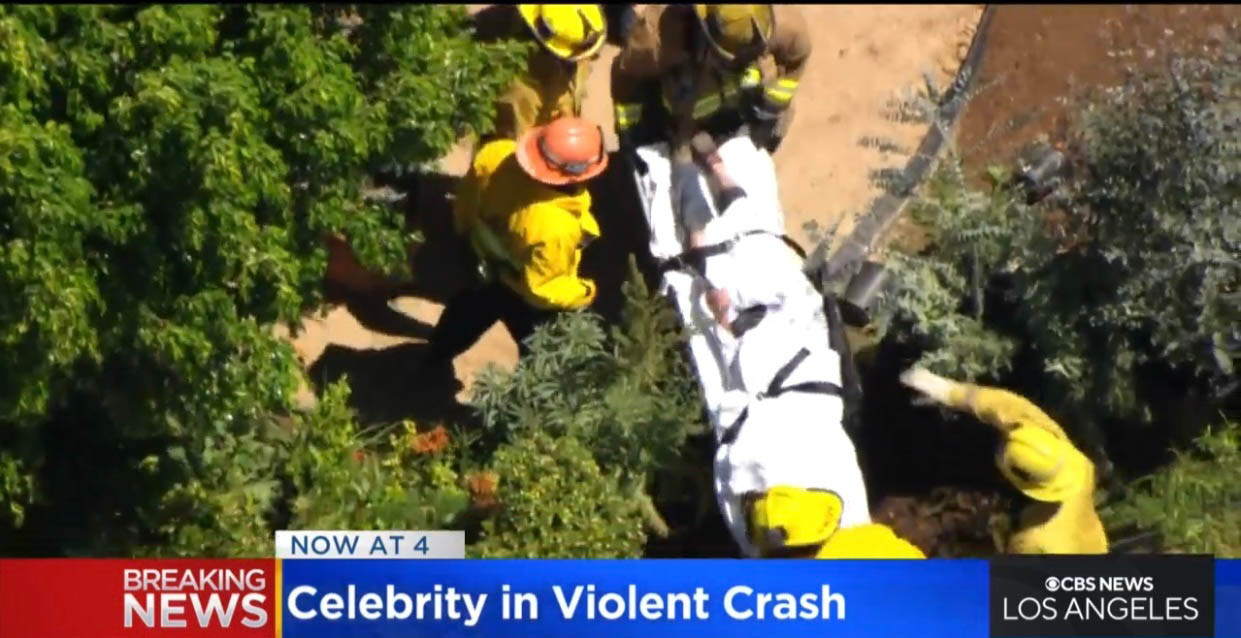 安妮希治自驾撞民宅火烧车  严重烧伤命危