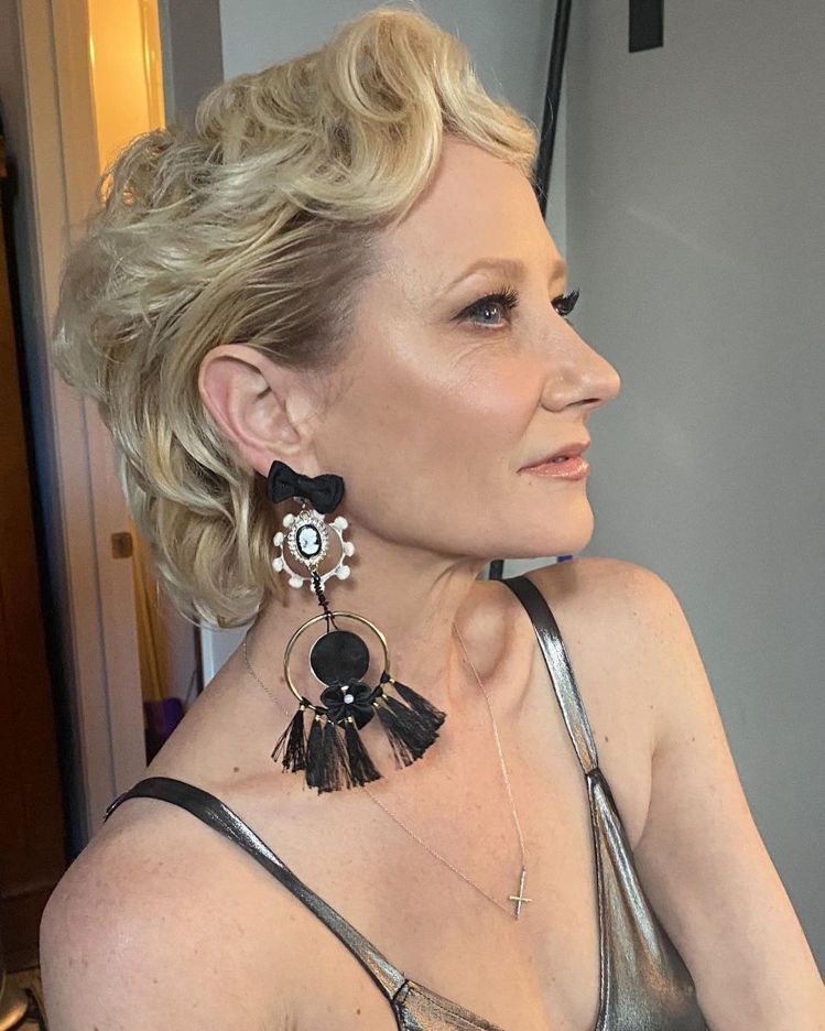 安妮希治自驾撞民宅火烧车  严重烧伤命危