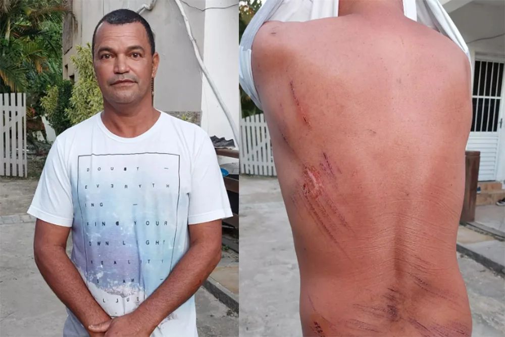 拼盘/观浪被卷入海中流落无人岛 男靠吃柠檬木炭奇迹存活5天获救