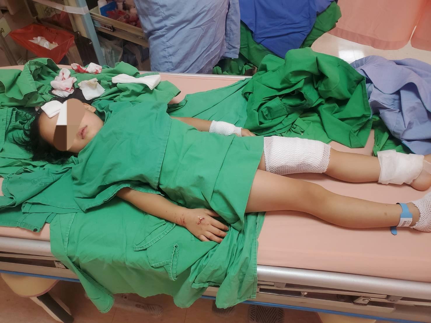 民宿玻璃门爆裂3女童伤 连续出事老板娘推说不知道