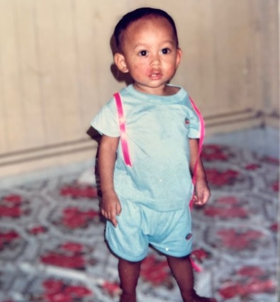 男子脸上胎记被嫌弃  老板：“你不适合前线工作”