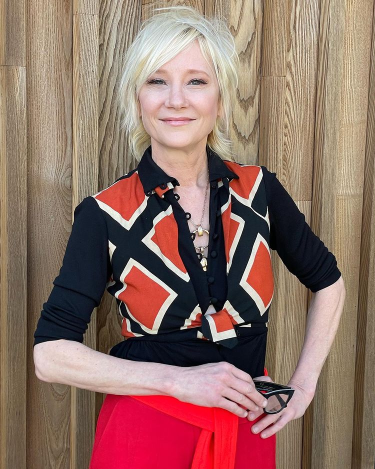 疑酒驾火烧车  安妮希治昏迷6天仍命危