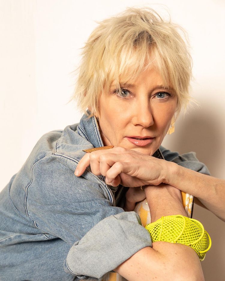 疑酒驾火烧车  安妮希治昏迷6天仍命危