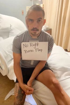 视频/被鳄鱼咬掉半边头骨 男子削头骨续命