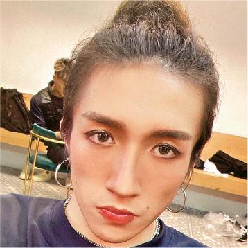 MIRROR演唱会|阿Mo术后第5天仍危殆 未来数周是自我恢复关键期