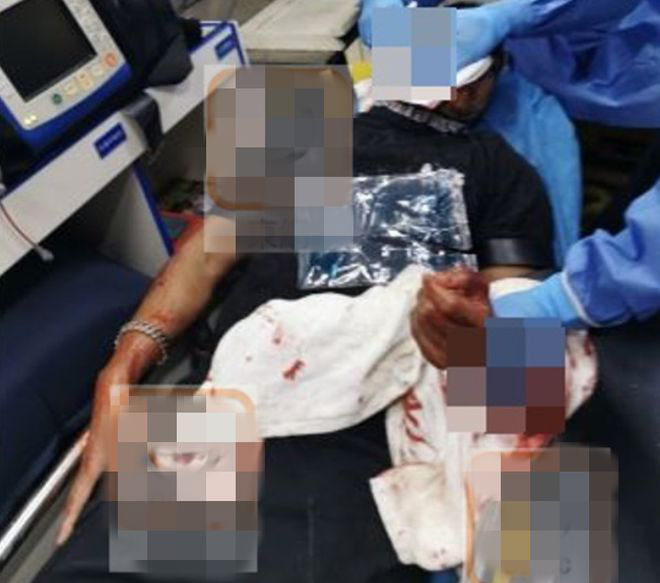 “翻版古天乐”遇袭被砍3刀  脸手缝100针凶徒竟称砍错人