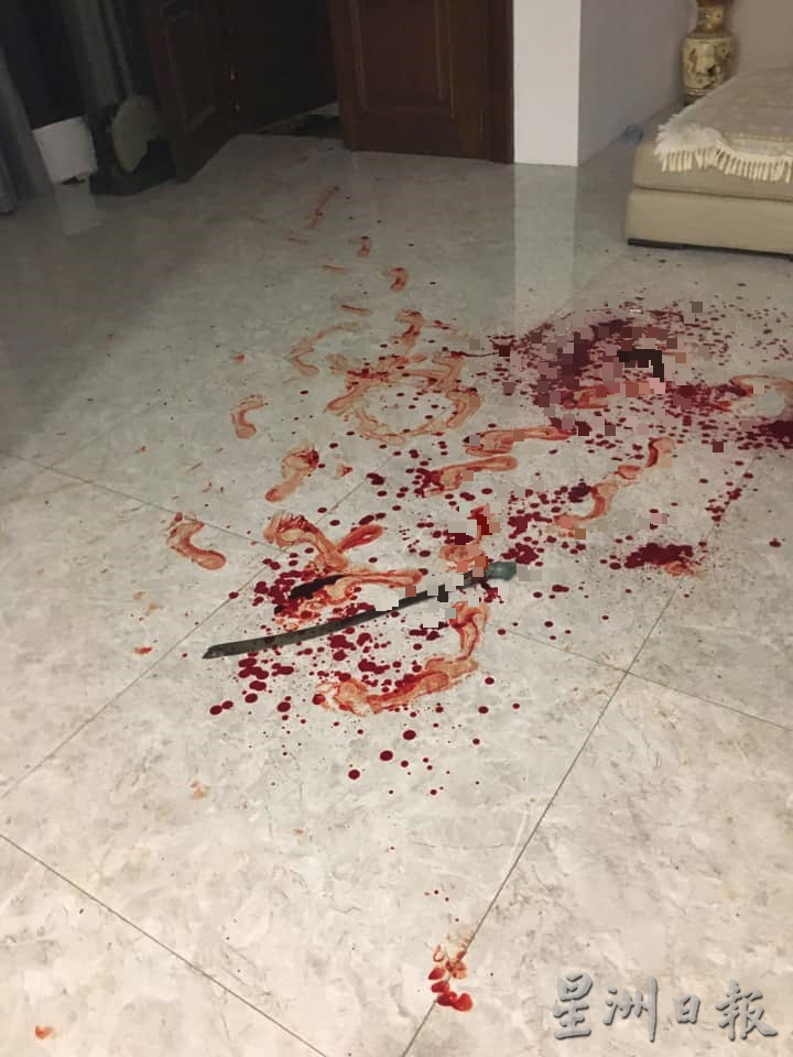 东:2名窃贼持利器入屋行窃并挥刀伤人，1名长者被挥中5刀，皮开肉绽。