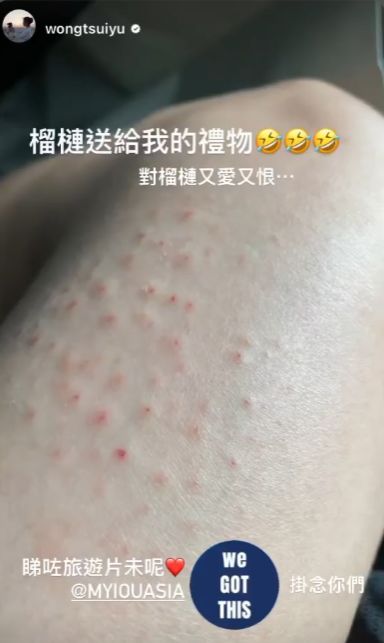 信喝山水会健康染肠病毒 黄翠如高烧不退以为确诊