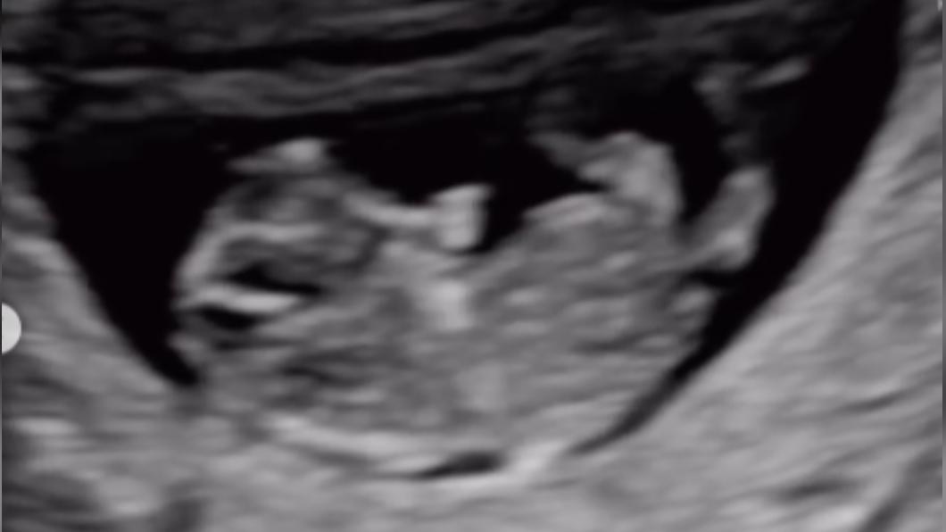 吴姗儒怀孕认已超过3个月 准外公吴宗宪:不管公的母的都开心