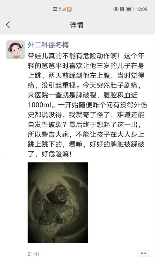 和3岁儿玩踩肚皮 爸爸脾脏被踩破