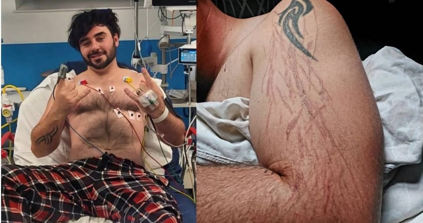 在家玩游戏被雷劈 男子留「星爆疤痕」幸运生还…出院买乐透还中奖!