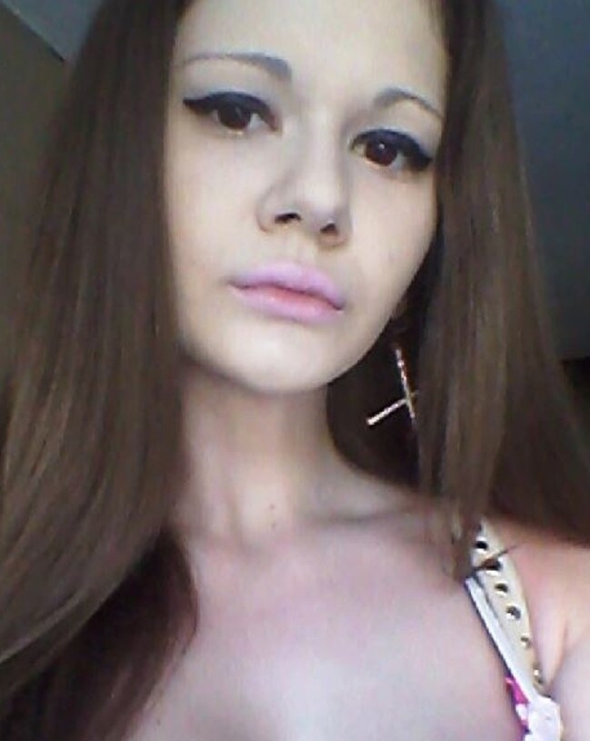 她狂打30次玻尿酸“丰唇变大香肠” 医警告:再整就堵住鼻孔