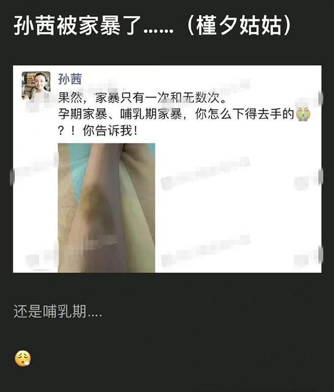 孙茜晒图遭疑孕期遭家暴   澄清非本人被亏想上热搜